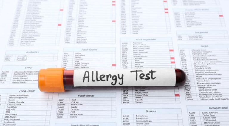 Everything You Need to Know about Allergy Blood Testing