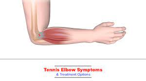 Your Best Treatment for Tennis Elbow Pain