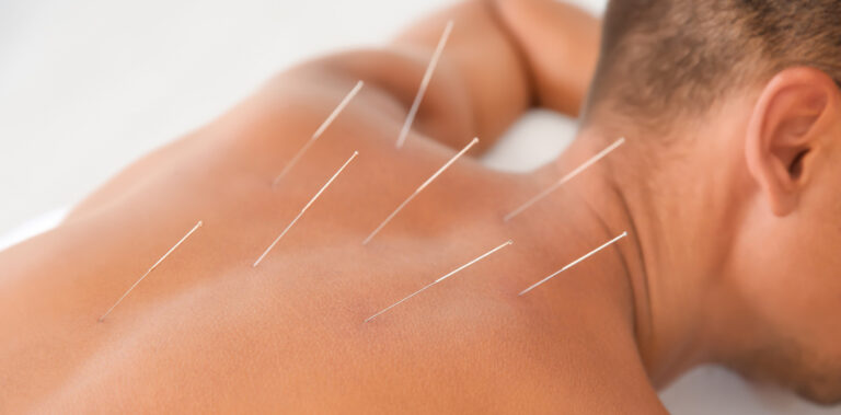 Acupuncture Ridgefield CT For Seniors: Promoting Health And Vitality In Aging Population