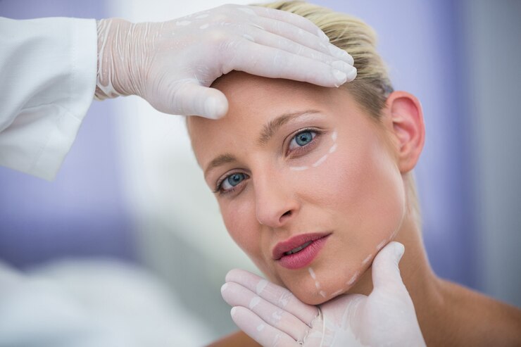 Essential Factors That Influence Blepharoplasty Surgery Prices in Houston