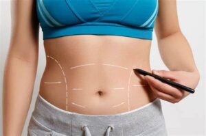 Tummy tuck surgery cost in Punjab