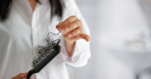 New Jersey hair loss treatment